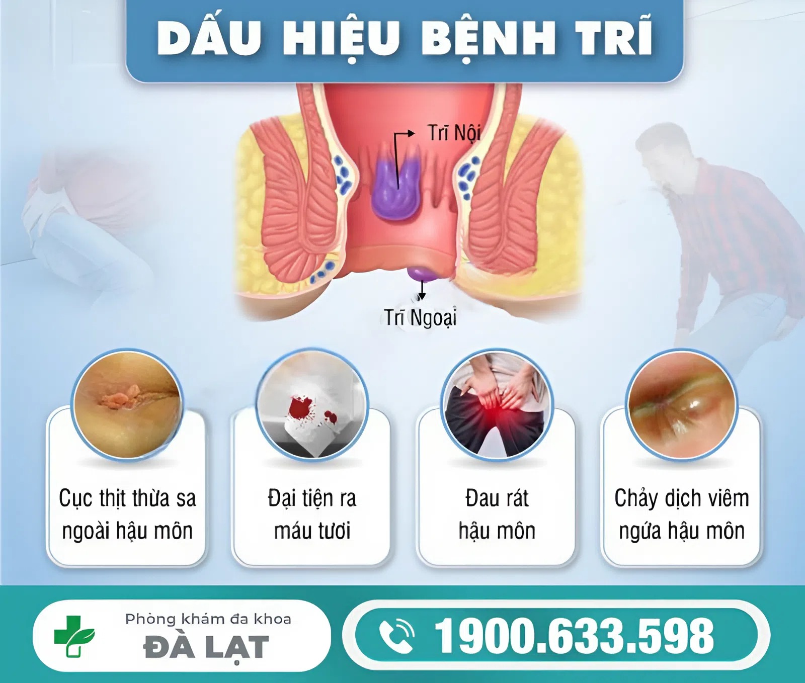 Hình ảnh minh họa